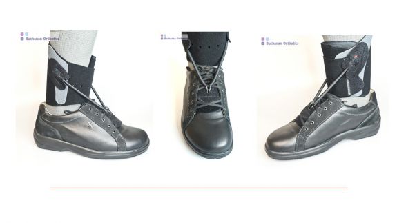 Airmed Textile foot drop orthosis fitted three views