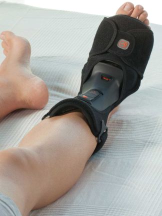Malleonite night splint on a foot in bed